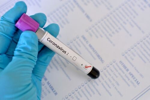 mais-quatro-casos-de-coronavirus-foram-confirmados-na-cidade